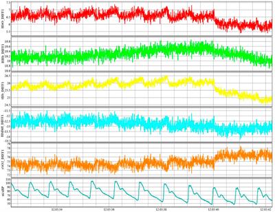 High spatial and temporal resolution cerebrovascular reactivity for humans and large mammals: A technological description of integrated fNIRS and niABP mapping system